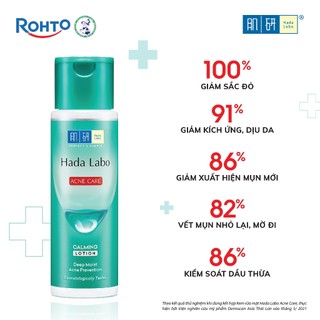 Nước dưỡng ẩm Hada Labo Acne Care Calming Lotion dành cho da dầu mụn, da nhạy cảm 170ml