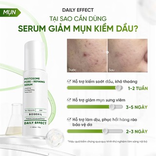 [Serum Giảm Mụn Và Kiểm Soát Dầu] DAILY EFFECT Phytosome Pore - Refining Serum (15g)