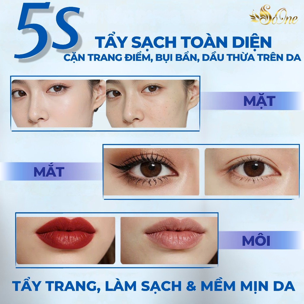 Nước Tẩy Trang SoOne Làm Sạch Sâu Cặn Trang Điểm,Không Cồn,Parapen,Hương Liệu Nắp Xanh Đậm 390ml