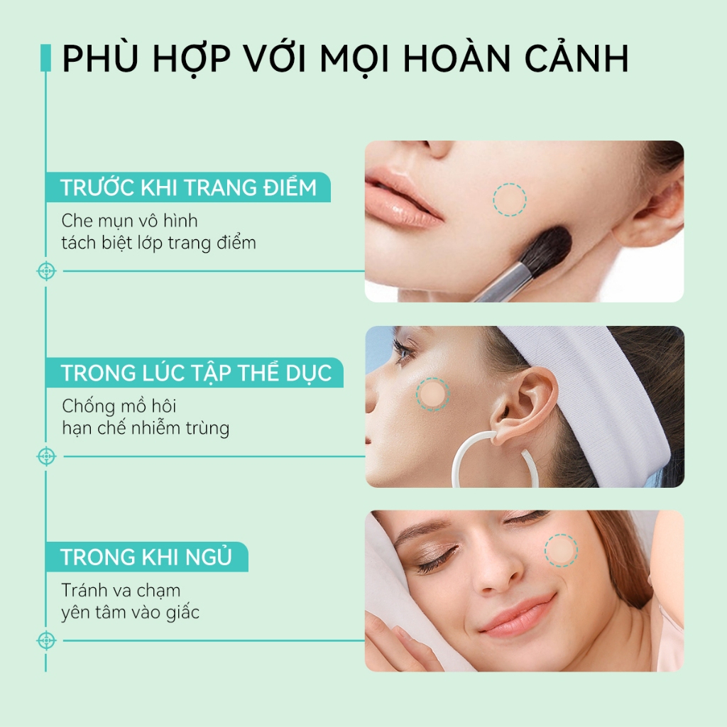 Miếng Dán Mụn Lanbena Invisible Acne Pimple Ban ngày và ban đêm