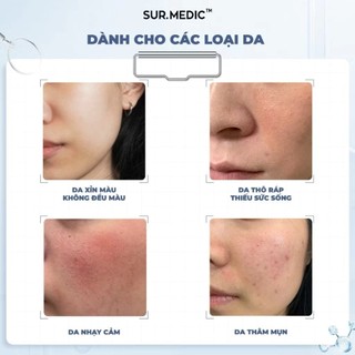Kem Dưỡng Sur.Medic Super Glutathione 1000TM Serum Sur.Medic Tinh Chất Huyết Thanh Trắng Da Sur.Medic - Skinora Beauty