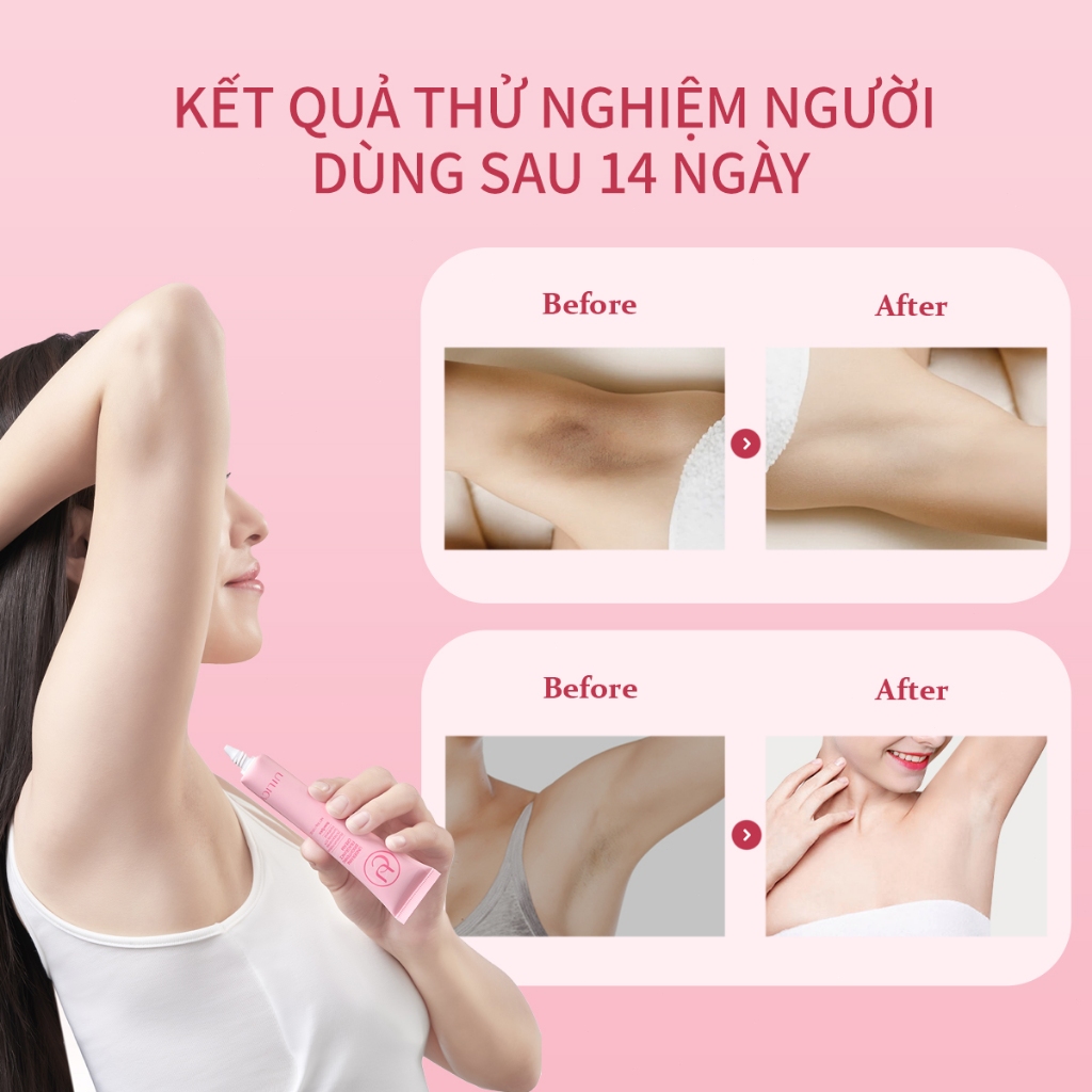Kem dưỡng Hỗ trợ trắng sáng vùng da dưới cánh tay UILICY30g Khử Mùi Nách Trắng da Chống2% Niacinamide Symwhite377 Rose