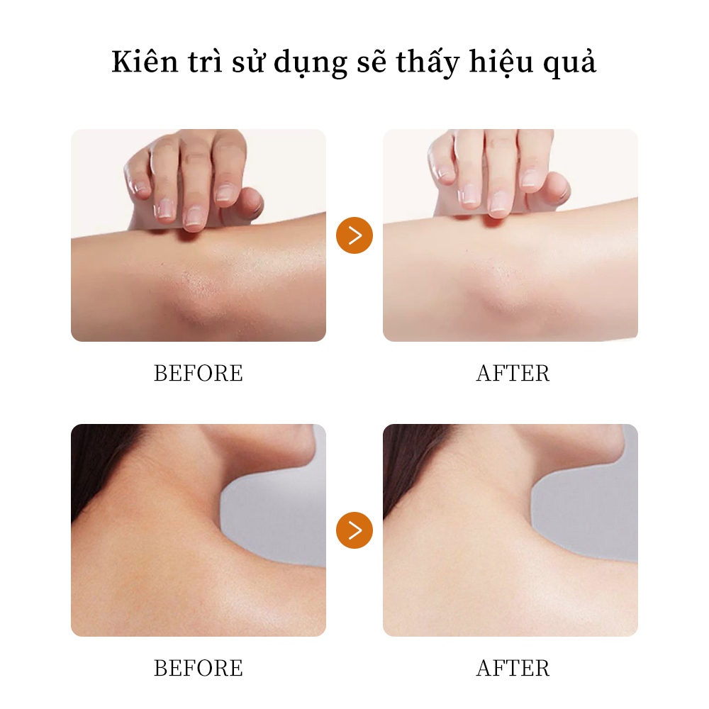 Kem dưỡng trắng da Vitamin C LYDIMOON 50g Làm mờ thâm vùng kín, nách, bẹn, mông, khớp Loại bỏ hắc tố dưỡng trắng