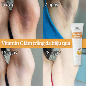 Kem dưỡng trắng da Vitamin C LYDIMOON 50g Làm mờ thâm vùng kín, nách, bẹn, mông, khớp Loại bỏ hắc tố dưỡng trắng