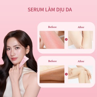 Bộ Tẩy Lông UILICY 70g + Serum 20ml Tẩy Lông Dịu Nhẹ Dưỡng Ẩm Phục Hồi Da Dùng Cho Nách Tay Chân