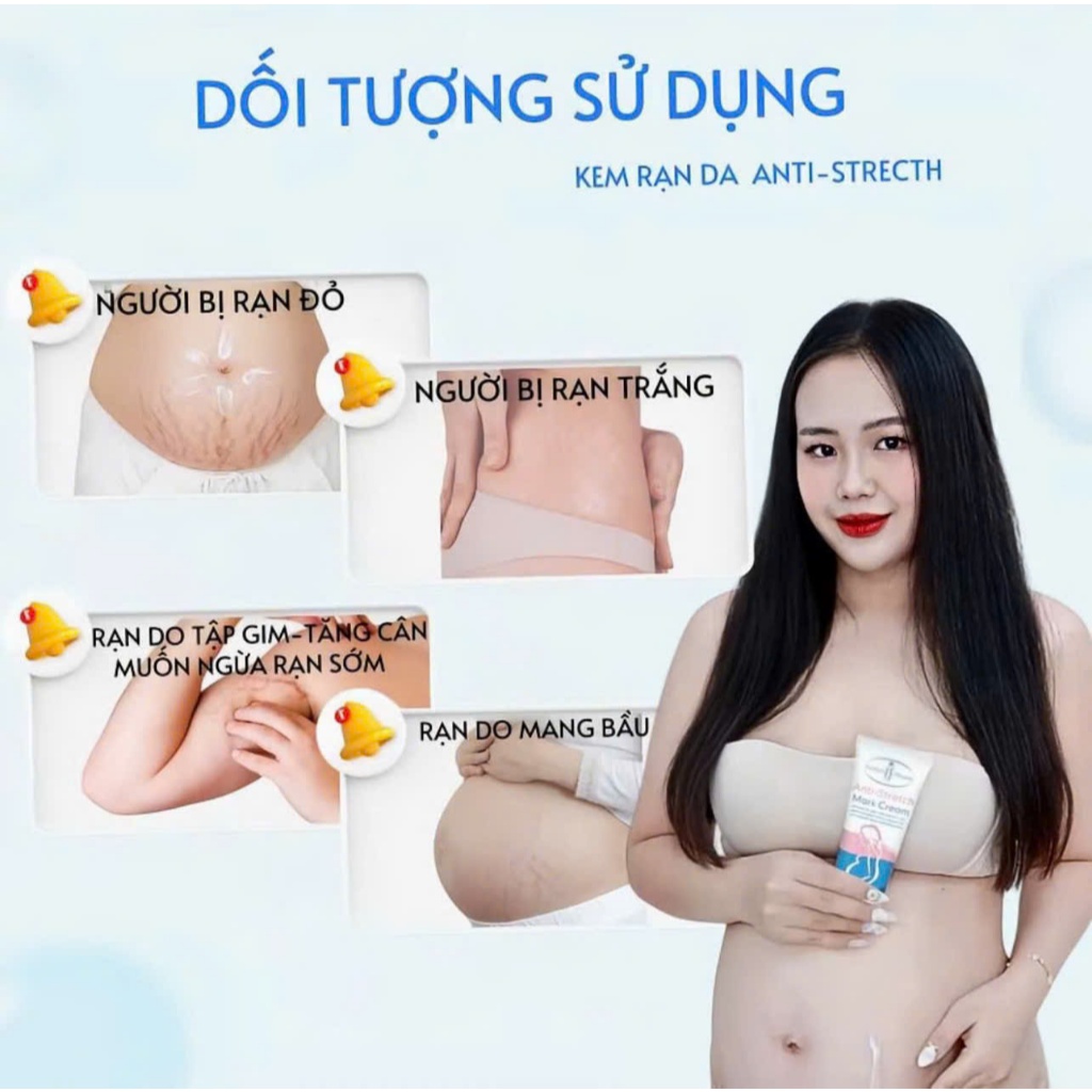 Kem Mờ Rạn Da Anti Strectch Dưỡng Ẩm, Hỗ Trợ Cải Thiện Thâm, Rạn Da Cho Mẹ Bầu Sau Sinh Và Tuổi Dậy Thì
