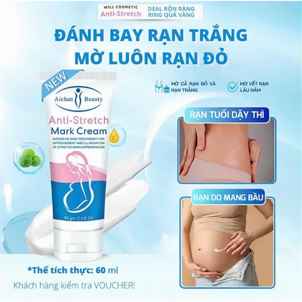 Kem Mờ Rạn Da Anti Strectch Dưỡng Ẩm, Hỗ Trợ Cải Thiện Thâm, Rạn Da Cho Mẹ Bầu Sau Sinh Và Tuổi Dậy Thì