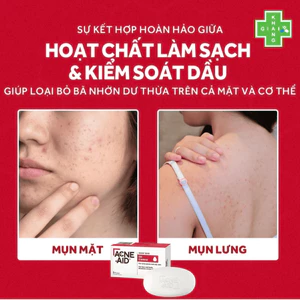 Chăm da body siêu đơn giản chuẩn y khoa cùng bánh tắm Acne Aid, giúp đánh bay mụn lưng, làm nhỏ lỗ chân lông (Hộp 100g)
