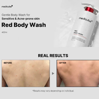 Sữa tắm medicube 400g/Red Acne Body Wash AHA BHA PHA dưỡng da mịn màng/hỗ trợ giảm mụn hiệu quả