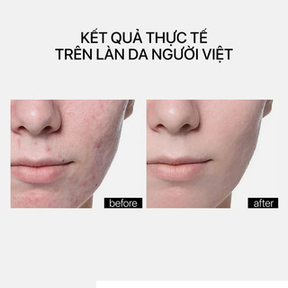 Seurm Chứa 3% Đồng Peptide Giúp Tái Tạo Và Phục Hồi Da Đa Tầng Theramid Copper Peptide