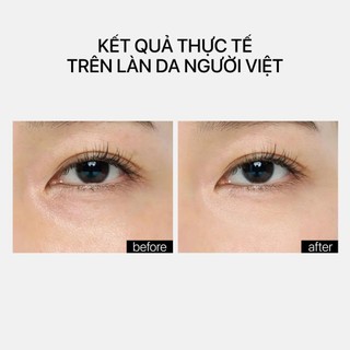 Serum Vitamin A Thế Hệ Mới Trẻ Hóa Da Toàn Diện Theramid A Retinyl Retinoid