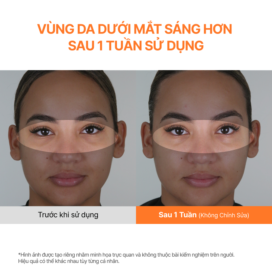 Serum Mắt Dưỡng Sáng, Mờ Thâm INNISFREE Vitamin C Niacinamide Brightening Eye Serum 10g