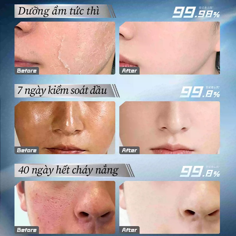 Kem dưỡng trắng da Ceramide LYDIMOON cấp ẩm sâu phục hồi hàng rào làm mềm da khô ráp căng mịn dành cho da nhạy cảm 50g