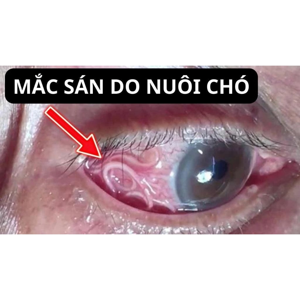 CÂY NGHỆ RĂM 1KG
