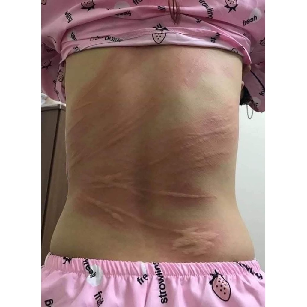 CÂY NGHỆ RĂM 1KG