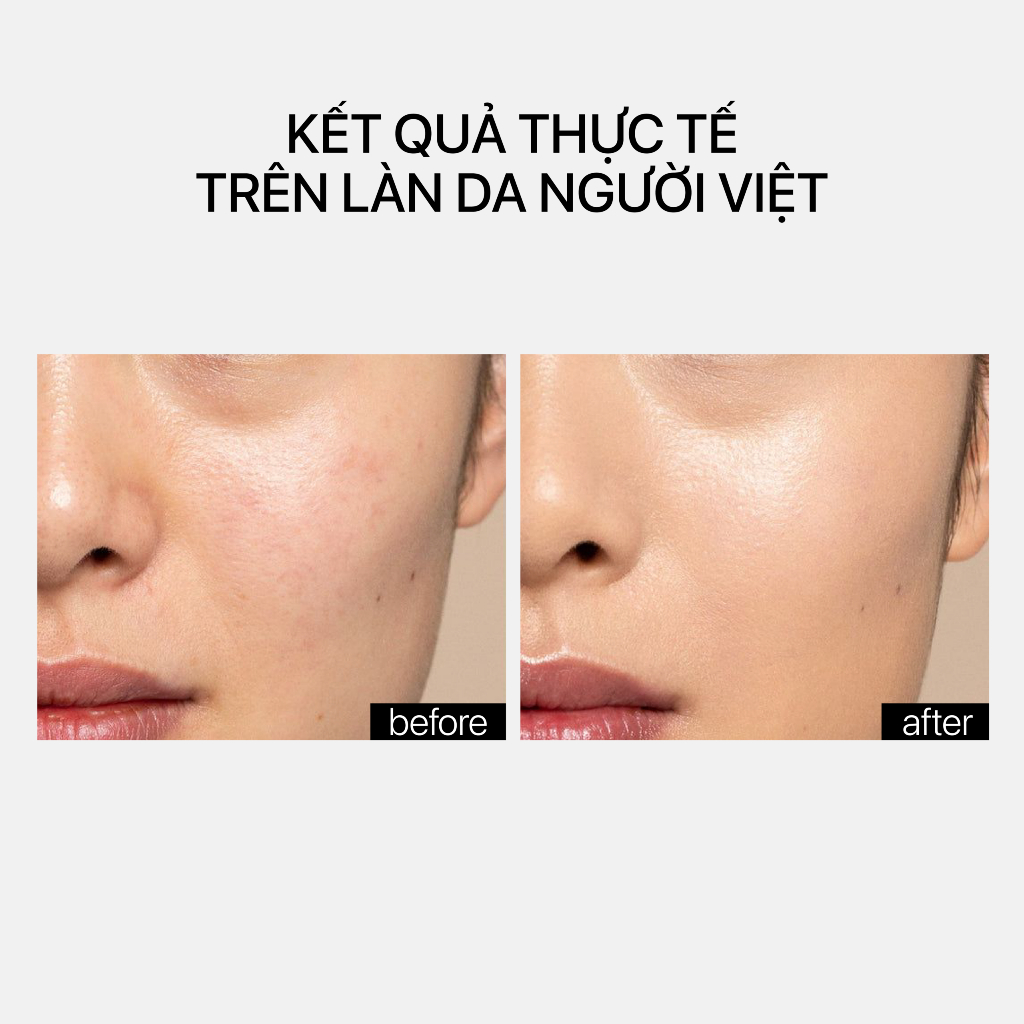 Serum Tái Tạo Da Theramid Smoothing Treatment 10% PHA 10% AHA Mandelic Acid Mờ Thâm Mịn Da Căng bóng 30ml