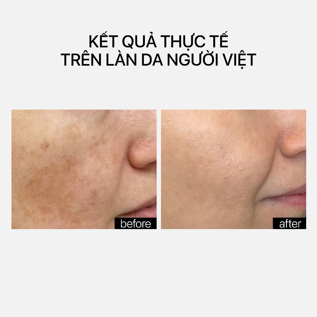 Serum làm sáng da, ngừa lão hóa THERAMID TETRAMID C.E.F.  3 Dạng Vitamin C Ferulic Acid  phức hợp chống oxy hóa, mờ thâm