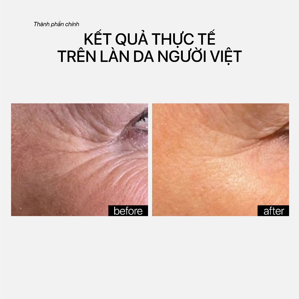 Serum ngừa lão hóa, mờ nhăn trẻ hóa da THERAMID DERMA-PEPTIDES 35% 9 Loại Peptide Kích Collagen Elastin Săn Chắc Da 30ml