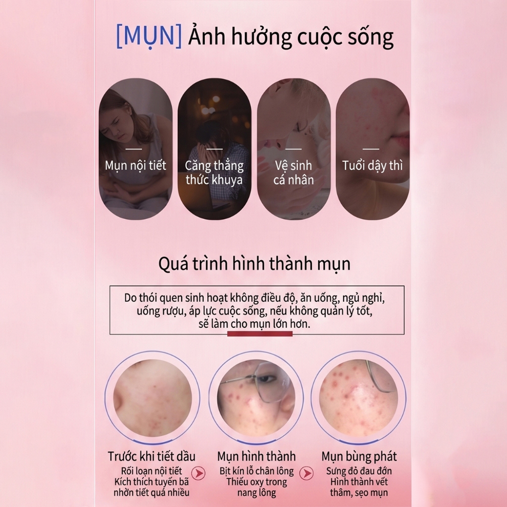 MaiWieel Miếng Dán Mụn 36 Miếng Day & Night Siêu Mỏng Vô Hình, Giảm Mụn Nhanh, Lành Sẹo Ngừa Thâm