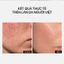 Kem Dưỡng Sáng Da TRANSPARENT 5% Niacinamide Glow Cream 50ml mờ thâm đều màu da,dưỡng ẩm săn chắc da