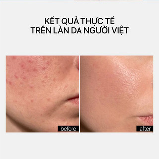 Kem Dưỡng Giúp Làm Sáng Da Và Chống Lão Hóa Transparent Lab Niacinamide Glow Cream
