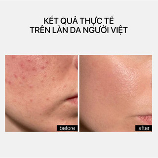 Kem Dưỡng Cấp Ẩm, Sáng Da Hiệu Ứng Glow Không Nhờn Rít Transparent Lab Niacinamide Glow Cream