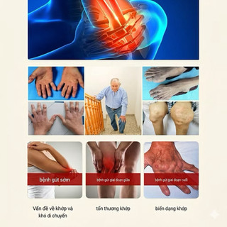 Kem Gout Thống Phong Biện Thị Bian Shi, Kem Xoa Bóp Thảo Dược Làm Ấm Da, Thư Giãn Vùng Khớp Cơ Thể