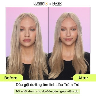 Dầu Gội HASK Tea Tree Oil+Rosemarry Chiết Xuất Tràm Trà, Hương Thảo 473ml-Làm Sạch, Kháng Khuẩn, Giảm Gàu Ngứa[34141AC]