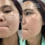 Kem Peel Làm Sáng Da, Mờ Thâm Nám & Tái Tạo Da Lightening innoaesthetics Vitamin A 5%