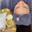 Kem Peel Làm Sáng Da, Mờ Thâm Nám & Tái Tạo Da Lightening innoaesthetics Vitamin A 5%