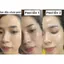 Peel Sáng Da, Mịn Da, Căng Bóng Tức Thì Gigi Ester C Mandelic peel 15% Professional 100ml