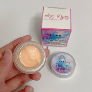 KEM MỤN ACNE MỸ LYN CHÍNH HÃNG [hũ 5gram - 10gram]