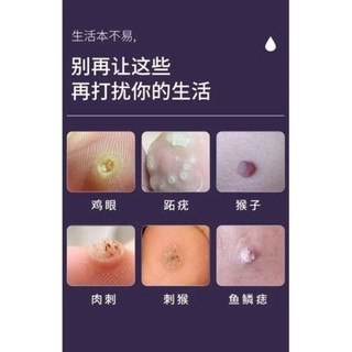 Kem Mụn Cóc Nhật Bản, Hỗ Trợ Làm Mềm Mụn Thịt Da Thừa Nốt Nhỏ Trên Da, Dễ Sử Dụng Tại Nhà An Toàn