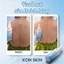 Xịt giảm mụn body Icon Skin Acne Free Solution 100ml | Giảm mụn và viêm vùng lưng, ngực, giúp da bod