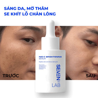 Serum dưỡng trắng da mặt nam giới Nio-Vitamin C SEVENLAB dưỡng sáng, mờ thâm mụn vượt trội 30ml