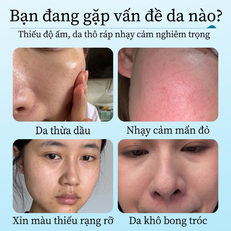 Kem dưỡng trắng da Ceramide LYDIMOON cấp ẩm sâu phục hồi hàng rào làm mềm da khô ráp căng mịn dành cho da nhạy cảm 50g