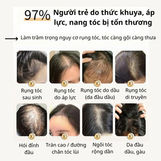 Dầu gội giảm gãy rụng tóc, hỗ trợ mọc tóc, sạch gàu ngứa Gừng Hà Thủ Ô - ĐỒNG NHÂN ĐƯỜNG 500ml
