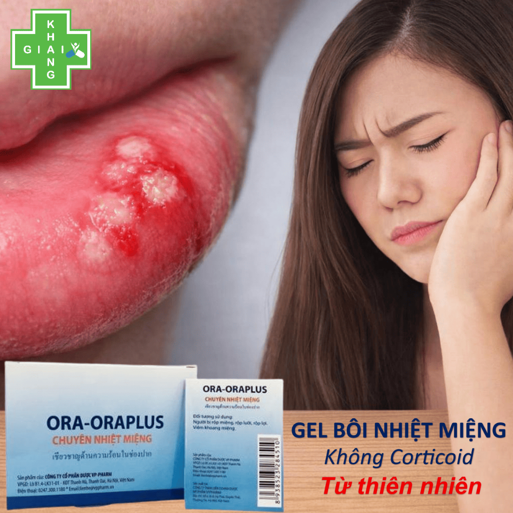 Tạm biệt cơn đau nhiệt miệng an toàn, hiệu quả từ thiên nhiên cùng Gel bôi Ora-OraPlus (Gói 1.5g)