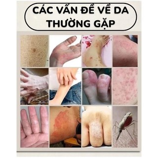 Kem Bôi Thảo Dược Bách Thảo Bá Vương 18G | Chăm Sóc Da Thảo Mộc Thiên Nhiên Dùng Ngoài Da Thấm Nhanh