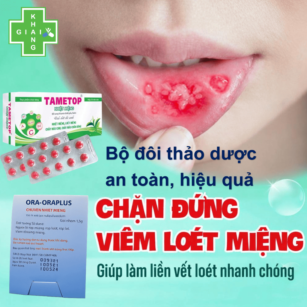 Tạm biệt cơn đau nhiệt miệng an toàn, hiệu quả từ thiên nhiên cùng Gel bôi Ora-OraPlus (Gói 1.5g)