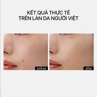 Tinh Chất 8 Loại Lipid Làm Khỏe Hàng Rào Bảo Vệ Da, Giảm Mất Nước, Chống Oxy Hóa THERAMID LINO-8