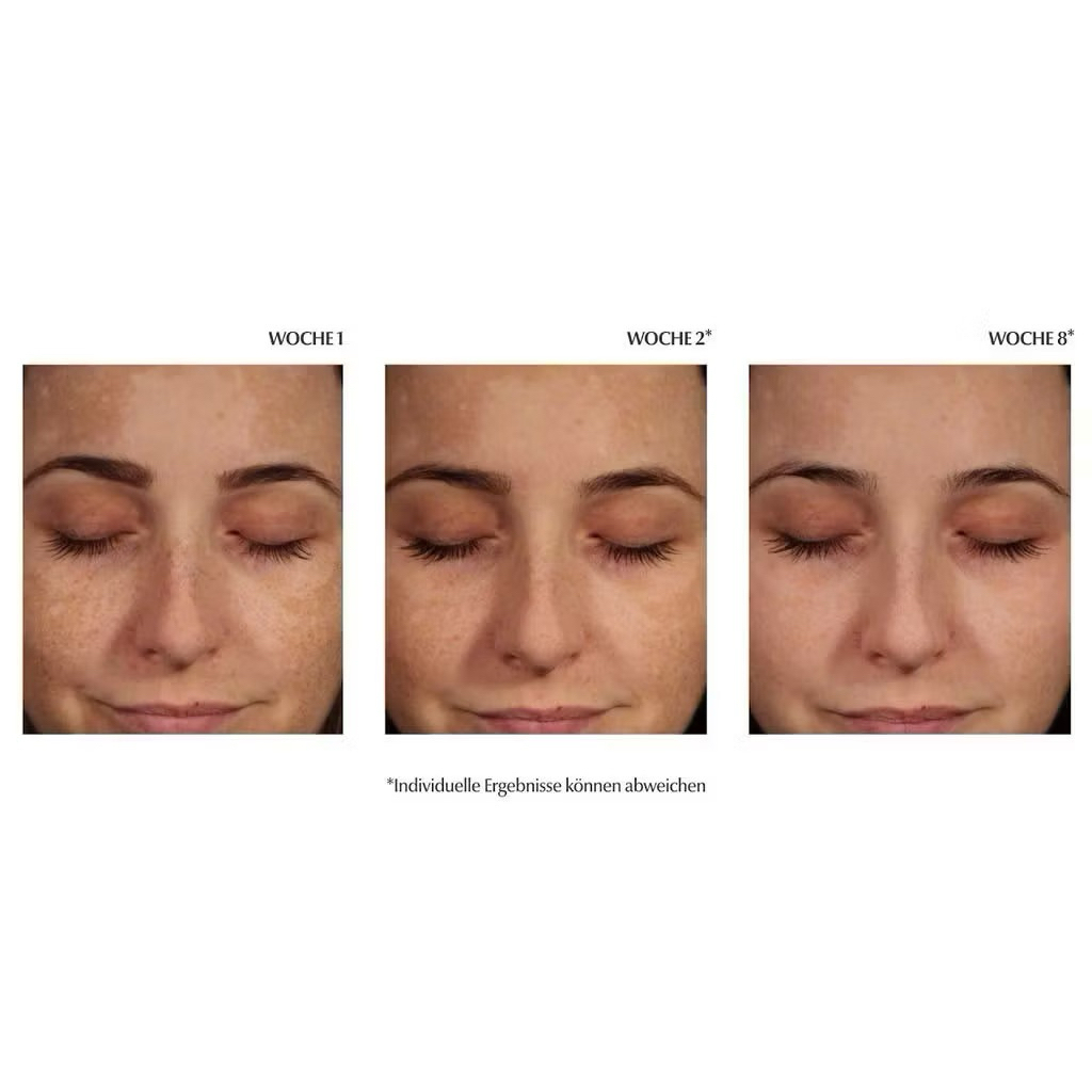 Serum Eucerin Spotless Brightening Booster Serum Thiamidol Mờ Thâm Nám Chính Hãng