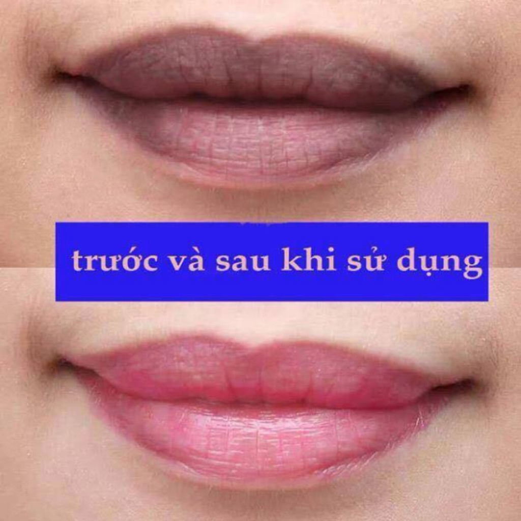SON DƯỠNG KHỬ THÂM MÔI MEDIHEAL