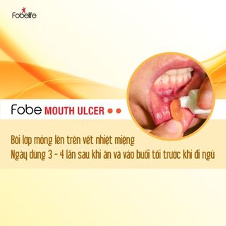 Gel Nhiệt Miệng Fobe - tuýp 10g, Giảm Đau Nhanh, Chống Viêm Loét Miệng Từ Thiên Nhiên, Đạt Chuẩn GMP