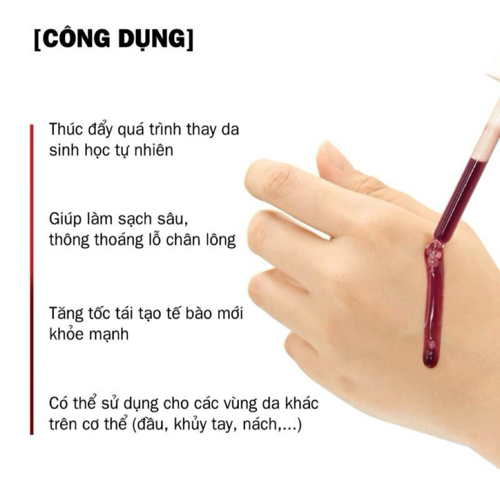 [ HOÀN TOÀN MỚI ] Peeling Ha Serum ( Giúp ngăn ngừa mụn, Se khít lỗ chân lông, Làm sáng da, Không sưng, Không bong )