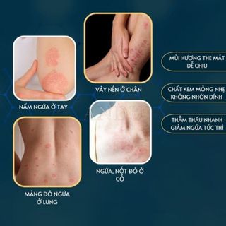 Homee.cok Kem Bôi Da Nhật Bản Hỗ Trợ Giảm Nấm Ngứa, Viêm Da, Hắc Lào, Ghẻ Nước – Dịu Da, Thấm Nhanh