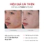 Fusion Retinol 0.3%, Tinh chất Retinol Dưỡng Da Săn Chắc & Mịn Màng 30ml