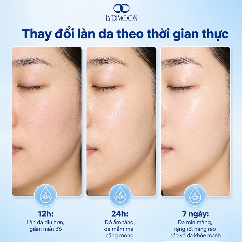 Kem dưỡng trắng da Ceramide LYDIMOON cấp ẩm sâu phục hồi hàng rào làm mềm da khô ráp căng mịn dành cho da nhạy cảm 50g
