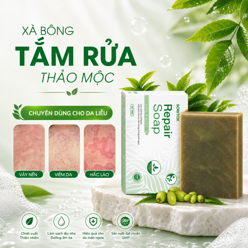 Xà Bông Thảo Mộc Giảm Vảy Nến, Viêm Da Cơ Địa, Hắc Lào, Ngứa Đỏ - Soritox 100Gr [XBT]
