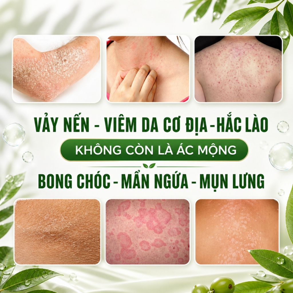 Xà Bông Tắm Cho Vảy Nến, Viêm Da, Ngứa Đỏ, Bong Chóc Từ Thảo Mộc Lá Neem Soritox 100Gr [XBX]